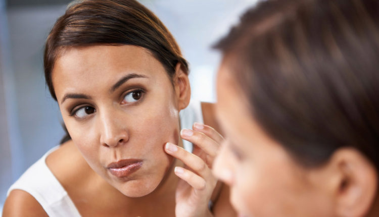 Are You Dealing With Pimples? Here Is Some Genuine Information For Your Guidance
